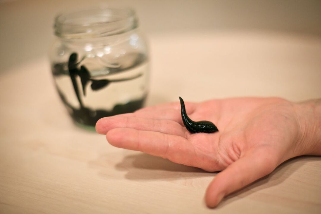 Leeches will be used as raw material for the production of cream that stimulates penis growth